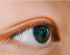 倒睫是由什么原因引起的？